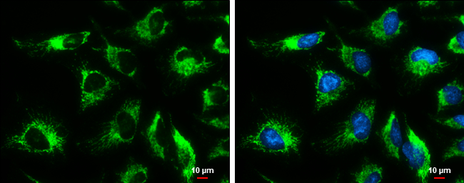 SOD2 antibody [GT17112] detects SOD2 protein at mitochondria by immunofluorescent analysis. Sample: HeLa cells were fixed in ice-cold MeOH for 5 min. Green: SOD2 stained by SOD2 antibody [GT17112] (GTX630560) diluted at 1:500. Blue: Hoechst 33342 staining. Scale bar= 10μm.