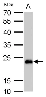 SOD2 antibody [GT17112] detects SOD2 protein by western blot analysis. A. 50 μg mouse brain lysate/extract 12 % SDS-PAGE SOD2 antibody [GT17112] (GTX630560) dilution: 1:1000