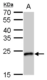 SOD2 antibody [GT17112] detects SOD2 protein by western blot analysis. A. 50 μg rat brain lysate/extract 12 % SDS-PAGE SOD2 antibody [GT17112] (GTX630560) dilution: 1:1000