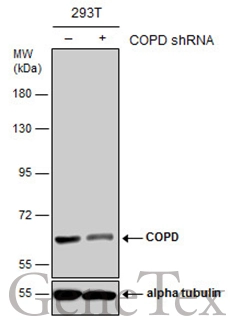 COPD antibody [GT189] detects COPD protein at cytoplasm by immunohistochemical analysis. Sample: Paraffin-embedded rat duodenum. COPD stained by COPD antibody [GT189] (GTX630561) diluted at 1:200. Antigen Retrieval: Citrate buffer,pH 6.0,15 min