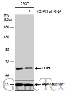 Non-transfected (–) and transfected (+) 293T whole cell extracts (30 μg) were separated by 7.5% SDS-PAGE, and the membrane was blotted with COPD antibody [GT189] (GTX630561) diluted at 1:20000.