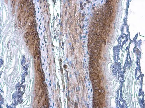 COPD antibody [GT189] detects COPD protein at cytoplasm by immunohistochemical analysis. Sample: Paraffin-embedded mouse esophagus. COPD stained by COPD antibody [GT189] (GTX630561) diluted at 1:200.
 Antigen Retrieval: Citrate buffer, pH 6.0, 15 min