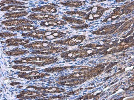 COPD antibody [GT189] detects COPD protein at cytoplasm by immunohistochemical analysis. Sample: Paraffin-embedded rat duodenum. COPD stained by COPD antibody [GT189] (GTX630561) diluted at 1:200.
 Antigen Retrieval: Citrate buffer, pH 6.0, 15 min