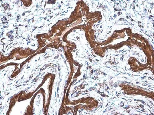 COPD antibody [GT1318] detects COPD protein at cytoplasm by immunohistochemical analysis. Sample: Paraffin-embedded rat urinary bladder. COPD stained by COPD antibody [GT1318] (GTX630562) diluted at 1:200.
 Antigen Retrieval: Citrate buffer, pH 6.0, 15 min