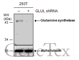 Glutamine synthetase antibody [GT1055] detects Glutamine synthetase protein on embryonic mouse brain by immunohistochemical analysis.