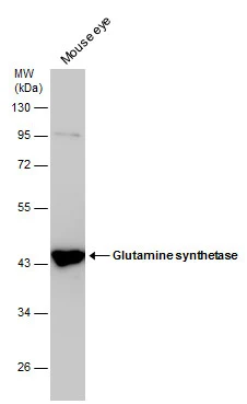 Mouse tissue extract (50 μg) was separated by 10% SDS-PAGE, and the membrane was blotted with Glutamine synthetase antibody (GTX630654) diluted at 1:1000.