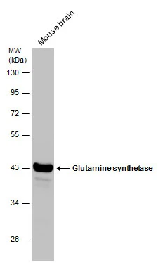 Anti-Glutamine synthetase antibody [GT1055] (GTX630654) | GeneTex