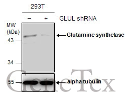 Non-transfected (–) and transfected (+) 293T whole cell extracts (30 μg) were separated by 10% SDS-PAGE, and the membrane was blotted with Glutamine synthetase antibody [GT7711] (GTX630657) diluted at 1:500.