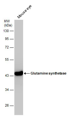Mouse tissue extract (50 μg) was separated by 10% SDS-PAGE, and the membrane was blotted with Glutamine synthetase antibody (GTX630657) diluted at 1:1000.