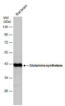 Non-transfected (�) and transfected (+) 293T whole cell extracts (30 ug) were separated by 10% SDS-PAGE,and the membrane was blotted with Glutamine synthetase antibody [GT7711] (GTX630657) diluted at 1:1000.