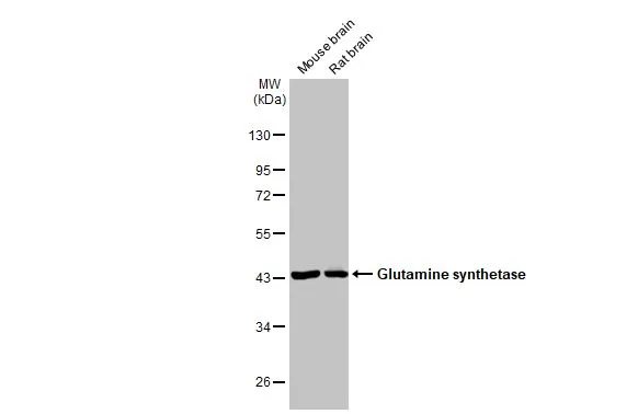 Various tissue extracts (50 μg) were separated by 10% SDS-PAGE, and the membrane was blotted with Glutamine synthetase antibody [GT7711] (GTX630657) diluted at 1:250000. The HRP-conjugated anti-mouse IgG antibody (GTX213111-01) was used to detect the primary antibody.