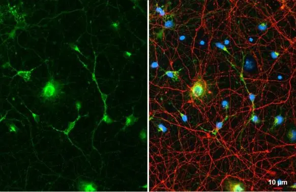 Glutamine synthetase antibody [GT7711] detects Glutamine synthetase protein in glial cells by immunofluorescent analysis. Sample: DIV10 rat E18 primary cortical neuron & glia cells were fixed in 4% paraformaldehyde at RT for 15 min. Green: Glutamine synthetase stained by Glutamine synthetase antibody [GT7711] (GTX630657) diluted at 1:500. Red: Tau, a Tau marker, stained by Tau antibody (GTX130462) diluted at 1:500. Blue: Fluoroshield with DAPI (GTX30920).