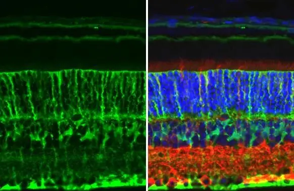 Glutamine synthetase antibody [GT7711] detects Glutamine synthetase protein at cell membrane by immunohistochemical analysis. Sample: Paraffin-embedded mouse eye. Green: Glutamine synthetase stained by Glutamine synthetase antibody [GT7711] (GTX630657) diluted at 1:200. Red: beta Tubulin 3/ Tuj1 , a Cytoskeleton marker, stained by beta Tubulin 3/ Tuj1 antibody [GT11710] (GTX631836) diluted at 1:500. Blue: Fluoroshield with DAPI (GTX30920). Antigen Retrieval: Citrate buffer, pH 6.0, 15 min