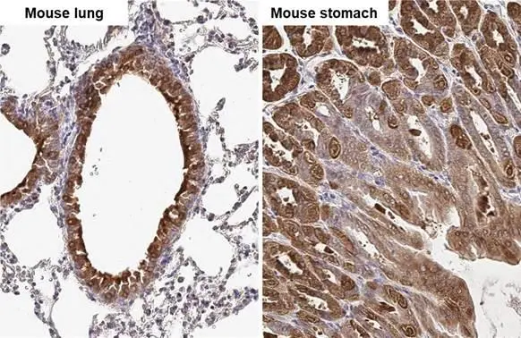 Anti-Glutamine synthetase antibody [GT7711] (GTX630657