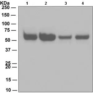 WB analysis of lysates from (1) etoposide-treated Jurkat, (2) untreated Jurkat, (3) staurosporine-treated HeLa and (4) untreated HeLa cells (10 microg per lane) using Caspase 8 antibody [EPR162] at a dilution of 1:1,000.