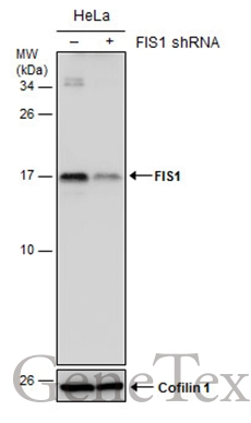 Non-transfected (–) and transfected (+) HeLa whole cell extracts (30 μg) were separated by 15% SDS-PAGE, and the membrane was blotted with FIS1 antibody [GT4211] (GTX630983) diluted at 1:500.