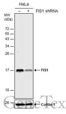 Non-transfected (–) and transfected (+) HeLa whole cell extracts (30 μg) were separated by 15% SDS-PAGE, and the membrane was blotted with FIS1 antibody [GT12112] (GTX630992) diluted at 1:500.