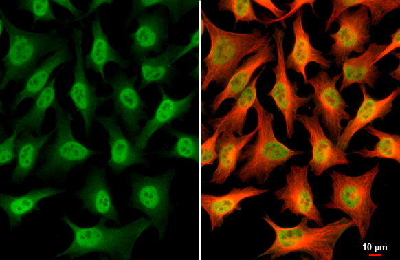 USP7 antibody [GT481] detects USP7 protein at cytoplasm and nucleus by immunofluorescent analysis. Sample: HeLa cells were fixed in 4% paraformaldehyde at RT for 15 min. Green: USP7 stained by USP7 antibody [GT481] (GTX631108) diluted at 1:500. Red: beta Tubulin, a cytoskeleton marker, stained by beta Tubulin antibody (GTX101279) diluted at 1:1000. Scale bar= 10μm.