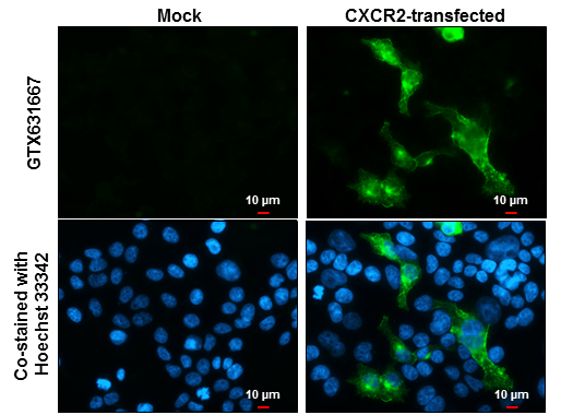 CXCR2 antibody [GT547] detects CXCR2 protein by immunofluorescent analysis. Sample: Mock and transfected 293T cells were fixed in 4% paraformaldehyde at RT for 15 min. Green: CXCR2 stained by CXCR2 antibody [GT547] (GTX631667) diluted at 1:2000. Blue: Hoechst 33342 staining. Scale bar= 10μm.