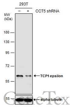 Various whole cell extracts (30 ug) were separated by 7.5% SDS-PAGE,and the membrane was blotted with TCP1 epsilon antibody [GT639] (GTX631668) diluted at 1:1000.