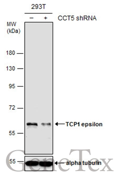 Non-transfected (–) and transfected (+) 293T whole cell extracts (30 μg) were separated by 7.5% SDS-PAGE, and the membrane was blotted with TCP1 epsilon antibody [GT639] (GTX631668) diluted at 1:1000.