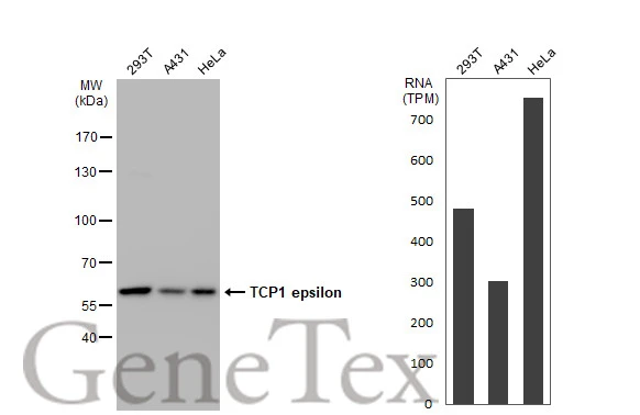 Various whole cell extracts (30 μg) were separated by 7.5% SDS-PAGE, and the membrane was blotted with TCP1 epsilon antibody [GT639] (GTX631668) diluted at 1:1000. The HRP-conjugated anti-mouset IgG antibody (GTX213111-01) was used to detect the primary antibody. Corresponding RNA expression data for the same cell lines are based on Human Protein Atlas program.