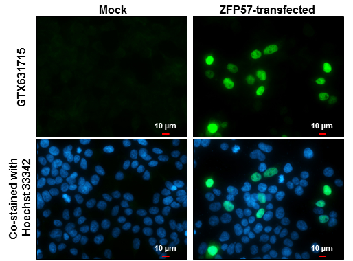 ZFP57 antibody [GT4512] detects ZFP57 protein at nucleus by immunofluorescent analysis. Sample: Mock and transfected 293T cells were fixed in 4% paraformaldehyde at RT for 15 min. Green: ZFP57 stained by ZFP57 antibody [GT4512] (GTX631715) diluted at 1:2000. Blue: Hoechst 33342 staining. Scale bar= 10 μm.