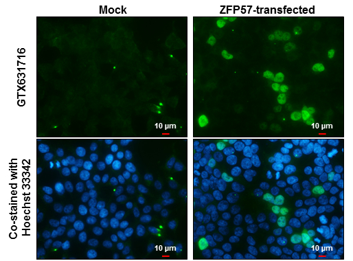 ZFP57 antibody [GT865] detects ZFP57 protein at nucleus by immunofluorescent analysis. Sample: Mock and transfected 293T cells were fixed in 4% paraformaldehyde at RT for 15 min. Green: ZFP57 stained by ZFP57 antibody [GT865] (GTX631716) diluted at 1:2000. Blue: Hoechst 33342 staining. Scale bar= 10 μm.
