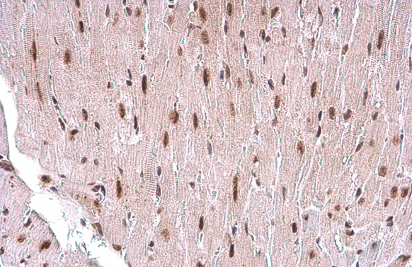 TDG antibody [GT1511] detects TDG protein at nucleus by immunohistochemical analysis. Sample: Paraffin-embedded mouse heart. TDG stained by TDG antibody [GT1511] (GTX631719) diluted at 1:200. Antigen Retrieval: Citrate buffer, pH 6.0, 15 min