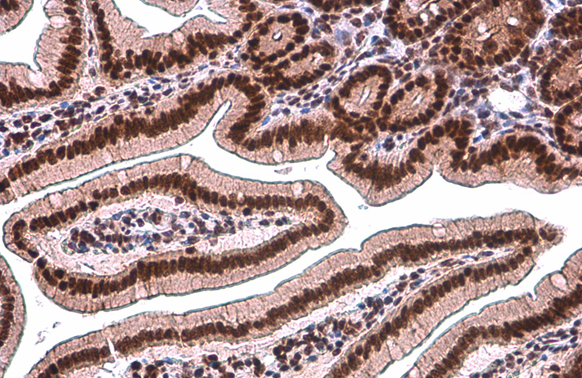 TDG antibody [GT1511] detects TDG protein at nucleus by immunohistochemical analysis. Sample: Paraffin-embedded rat intestine. TDG stained by TDG antibody [GT1511] (GTX631719) diluted at 1:200. Antigen Retrieval: Citrate buffer, pH 6.0, 15 min