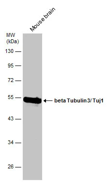 Mouse tissue extract (50 μg) was separated by 10% SDS-PAGE, and the membrane was blotted with beta Tubulin 3/ Tuj1 antibody [GT886] (GTX631830) diluted at 1:1000.