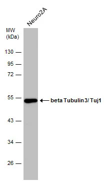 Whole cell extract (30 μg) was separated by 10% SDS-PAGE, and the membrane was blotted with beta Tubulin 3/ Tuj1 antibody [GT886] (GTX631830) diluted at 1:1000.