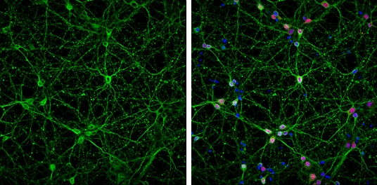 beta Tubulin 3/ Tuj1 antibody [GT886] detects beta Tubulin 3/ Tuj1 protein at cytoplasm by immunofluorescent analysis. Sample: DIV9 rat E18 primary cortical neurons were fixed in 4% paraformaldehyde at RT for 15 min. Green: beta Tubulin 3/ Tuj1 protein stained by beta Tubulin 3/ Tuj1 antibody [GT886] (GTX631830) diluted at 1:500. Red: NeuN, stained by NeuN antibody (GTX132974) diluted at 1:1000. Blue: Fluoroshield with DAPI (GTX30920).