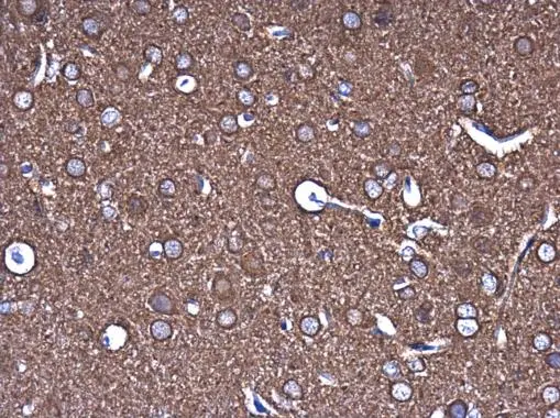 beta Tubulin 3/ Tuj1 antibody [GT886] detects beta Tubulin 3/ Tuj1 protein at cytoplasm by immunohistochemical analysis. Sample: Paraffin-embedded rat brain. beta Tubulin 3/ Tuj1 stained by beta Tubulin 3/ Tuj1 antibody [GT886] (GTX631830) diluted at 1:250.