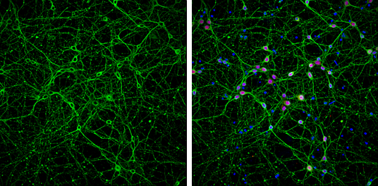 beta Tubulin 3/ Tuj1 antibody [GT1338] detects beta Tubulin 3/ Tuj1 protein at cytoplasm by immunofluorescent analysis. Sample: DIV9 rat E18 primary cortical neurons were fixed in 4% paraformaldehyde at RT for 15 min. Green: beta Tubulin 3/ Tuj1 protein stained by beta Tubulin 3/ Tuj1 antibody [GT1338] (GTX631831) diluted at 1:500. Red: NeuN, stained by NeuN antibody (GTX132974) diluted at 1:1000. Blue: Fluoroshield with DAPI (GTX30920).