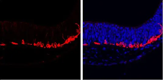 beta Tubulin 3/ Tuj1 antibody [GT1338] detects beta Tubulin 3/ Tuj1 protein at cytoplasm by immunohistochemical analysis. Sample: Paraffin-embedded mouse E10.5 embryo. Red: beta Tubulin 3/ Tuj1 stained by beta Tubulin 3/ Tuj1 antibody [GT1338] (GTX631831) diluted at 1:500. Blue: Fluoroshield with DAPI (GTX30920).