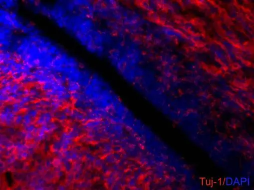 beta III Tubulin antibody [GT11710] detects beta III Tubulin proteins on embryonic mouse brain by immunohistochemical analysis. Sample:Frozen section of embryonic mouse brain (mE18.5). Red: beta III Tubulin antibody [GT11710] (GTX631836) diluted at 1:500. Blue: DAPI