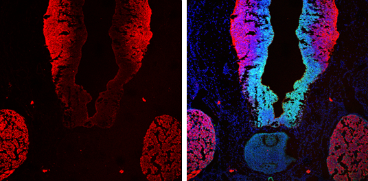 beta Tubulin 3/ TUJ1 antibody [GT11710] detects beta Tubulin 3/ TUJ1 protein by immunohistochemical analysis. Sample: Frozen sectioned E13.5 rat brain. Green: SOX2 protein stained by SOX2 antibody [N1C3] (GTX101507) diluted at 1:250. Red: beta Tubulin 3/ TUJ1 protein stained by beta Tubulin 3/ TUJ1 antibody [GT11710] (GTX131836) diluted at 1:250. Blue: Fluoroshield with DAPI (GTX30920).