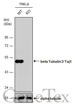 Wild-type (WT) and beta Tubulin 3/ Tuj1 knockout (KO) HeLa cell extracts (30 μg) were separated by 10% SDS-PAGE, and the membrane was blotted with beta Tubulin 3/ Tuj1 antibody [GT11710] (GTX631836) diluted at 1:2500. The HRP-conjugated anti-mouse IgG antibody (GTX213111-01) was used to detect the primary antibody, and the signal was developed with Trident ECL plus-Enhanced.