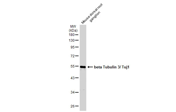 beta Tubulin 3/ TUJ1 antibody [GT11710] detects beta Tubulin 3/ TUJ1 protein by immunohistochemical analysis.