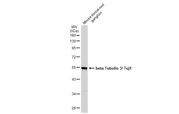 Mouse tissue extract (30 μg) was separated by 10% SDS-PAGE, and the membrane was blotted with beta Tubulin 3/ Tuj1 antibody [GT11710] (GTX631836) diluted at 1:5000. The HRP-conjugated anti-mouse IgG antibody (GTX213111-01) was used to detect the primary antibody.