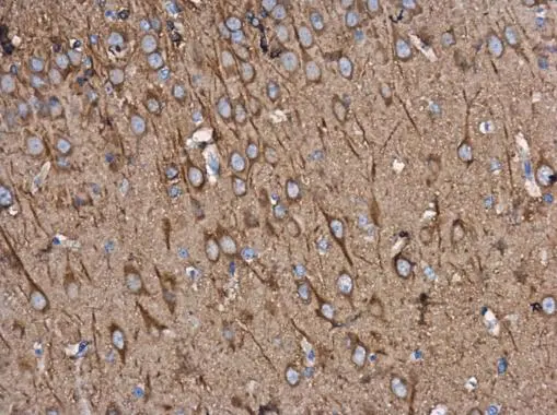 beta Tubulin 3/ TUJ1 antibody [GT11710] detects beta Tubulin 3/ TUJ1 protein at cytoplasm in rat brain by immunohistochemical analysis. Sample: Paraffin-embedded rat brain. beta Tubulin 3/ TUJ1 antibody [GT11710] (GTX631836) diluted at 1:500. 
 Antigen Retrieval: Citrate buffer, pH 6.0, 15 min