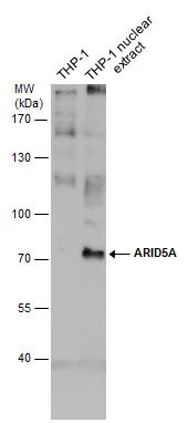 THP-1 whole cell and nuclear extracts (30 μg) were separated by 7.5% SDS-PAGE, and the membrane was blotted with ARID5A antibody [GT921] (GTX631938) diluted at 1:500. The signal was developed with Trident ECL plus-Enhanced.