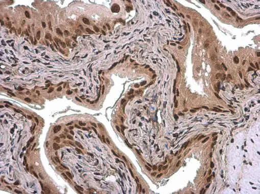 ARID5A antibody [GT1683] detects ARID5A protein at nucleus by immunohistochemical analysis. Sample: Paraffin-embedded mouse urinary bladder. ARID5A stained by ARID5A antibody [GT1683] (GTX631939) diluted at 1:200.
 Antigen Retrieval: Citrate buffer, pH 6.0, 15 min