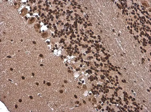 ARID5A antibody [GT1683] detects ARID5A protein at nucleus by immunohistochemical analysis. Sample: Paraffin-embedded mouse brain. ARID5A stained by ARID5A antibody [GT1683] (GTX631939) diluted at 1:200.
 Antigen Retrieval: Citrate buffer, pH 6.0, 15 min