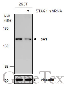 Non-transfected (–) and transfected (+) 293T whole cell extracts (30 μg) were separated by 5% SDS-PAGE, and the membrane was blotted with SA1 antibody [GT8810] (GTX631989) diluted at 1:500.