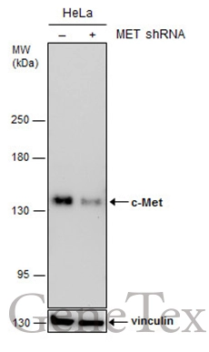 Non-transfected (–) and transfected (+) HeLa whole cell extracts (30 μg) were separated by 5% SDS-PAGE, and the membrane was blotted with c-Met antibody [GT556] (GTX631992) diluted at 1:500.