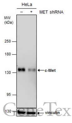 Non-transfected (–) and transfected (+) HeLa whole cell extracts (30 μg) were separated by 5% SDS-PAGE, and the membrane was blotted with c-Met antibody [GT1586] (GTX631993) diluted at 1:500.