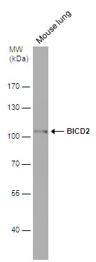 Mouse tissue extract (50 μg) was separated by 7.5% SDS-PAGE, and the membrane was blotted with BICD2 antibody [GT10811] (GTX631994) diluted at 1:1000.