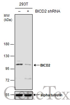 Non-transfected (–) and transfected (+) 293T whole cell extracts (30 μg) were separated by 7.5% SDS-PAGE, and the membrane was blotted with BICD2 antibody [GT1824] (GTX631995) diluted at 1:500.